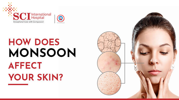 How Does Monsoon Affect Your Skin?