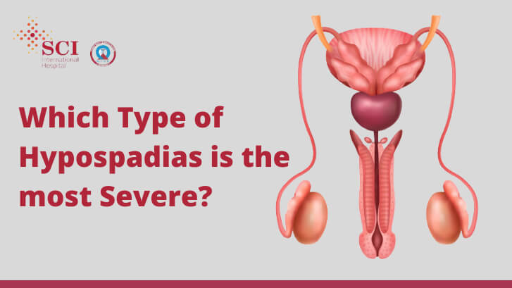 Which type of hypospadias is the most severe?