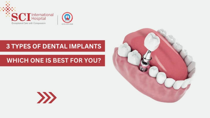 3 Types of Dental Implants: Which One Is Right for You?