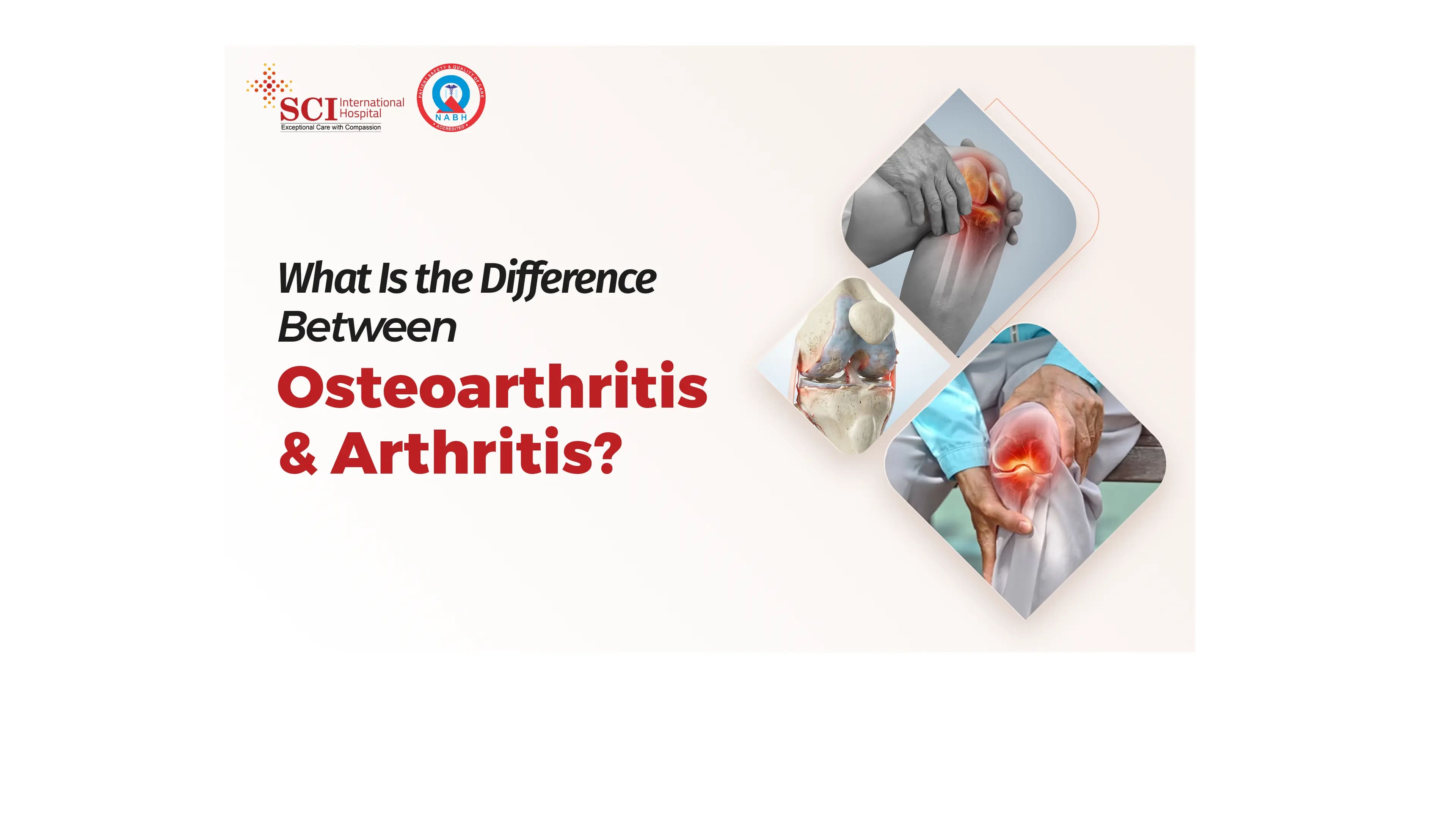 What Is the Difference Between Osteoarthritis and Arthritis?