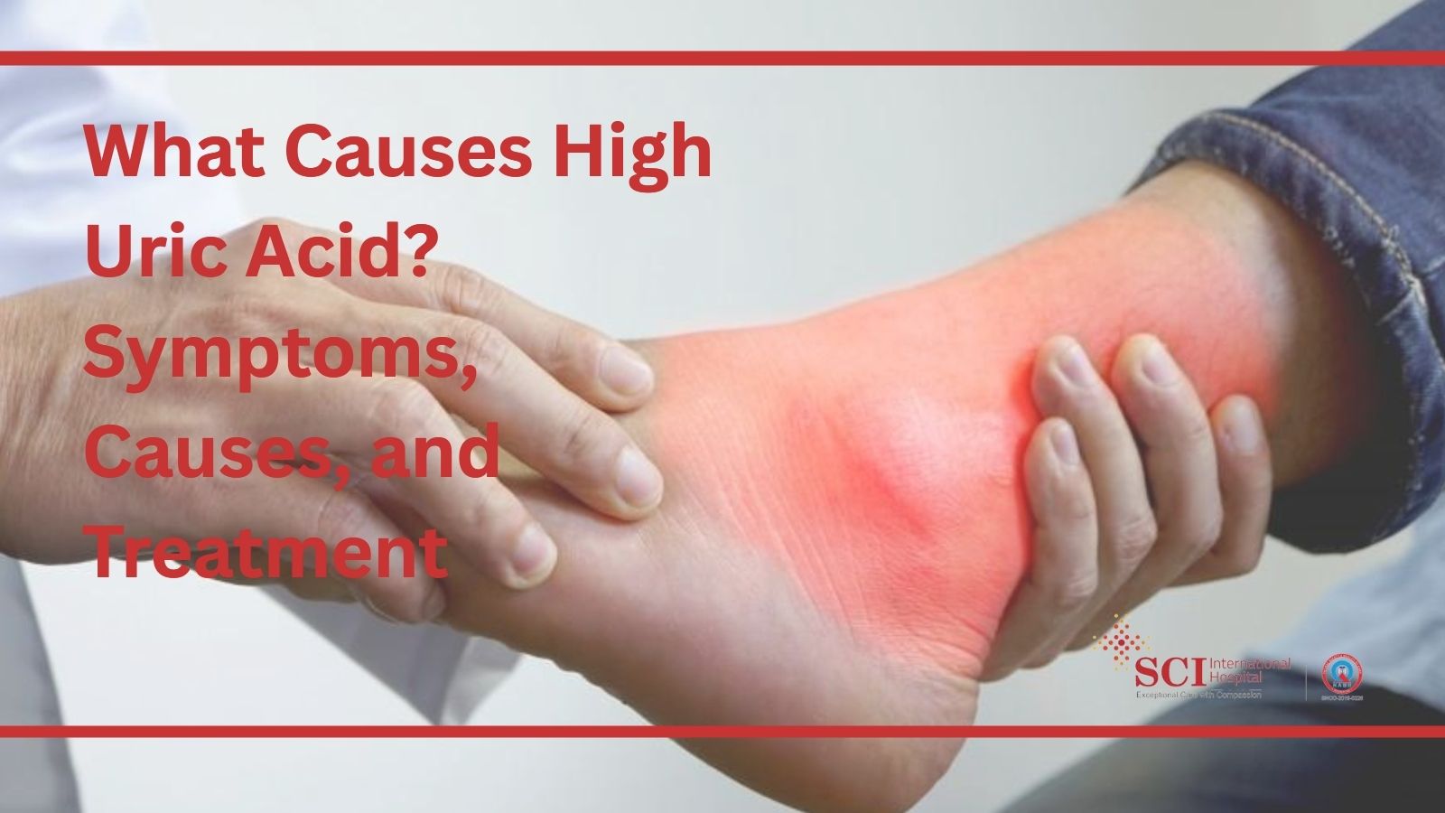 What Causes High Uric Acid? Symptoms, Causes, and Treatment