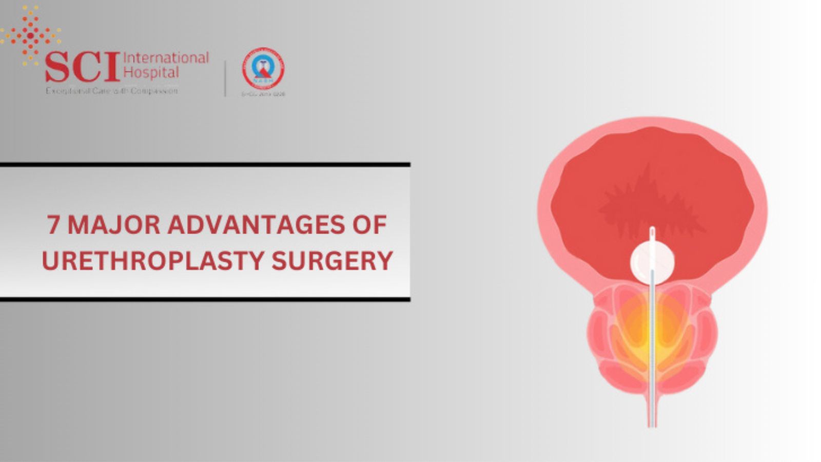 7 Major Advantages of Urethroplasty Surgery