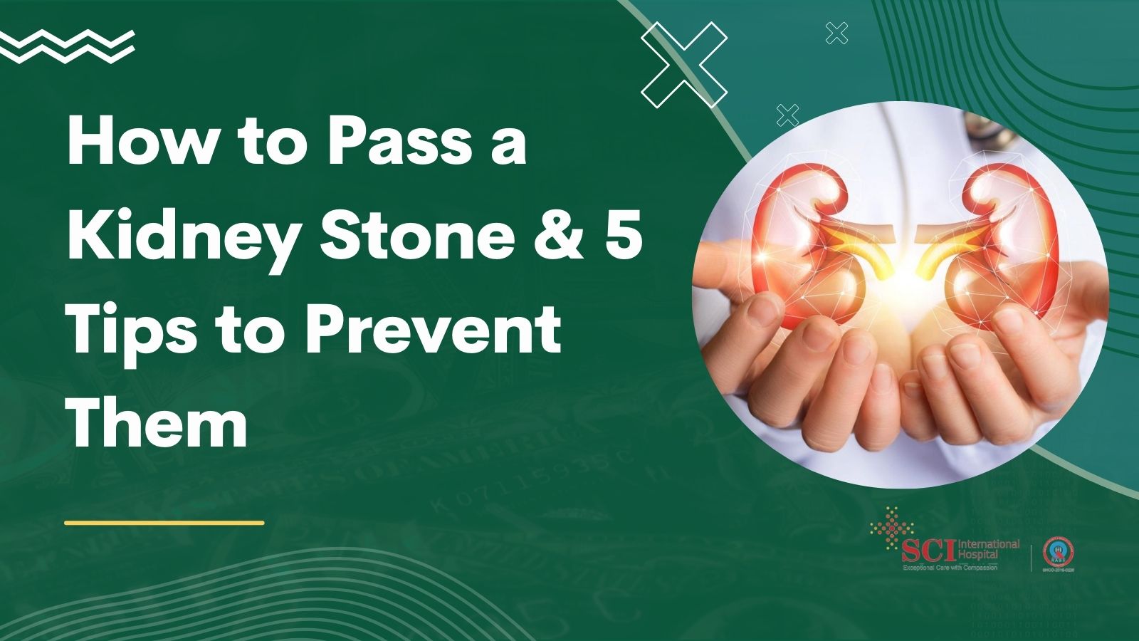How to Pass a Kidney Stone & 5 Tips to Prevent Them