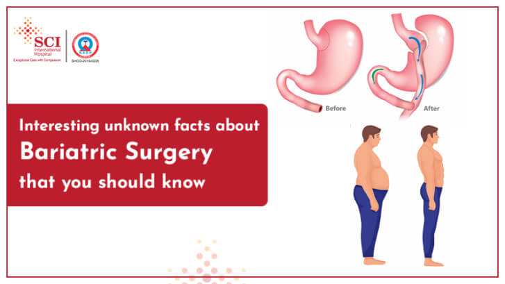 Bariatric Surgery Some Unknown Facts You Must Know