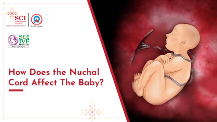 How Does the Nuchal Cord Affect The Baby?
